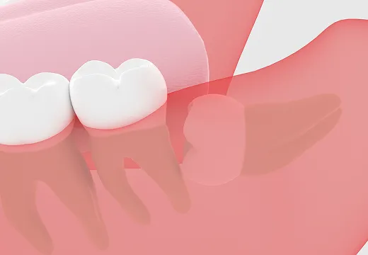 Concept Image