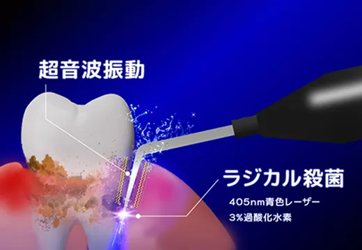 ブルーラジカルの 技術