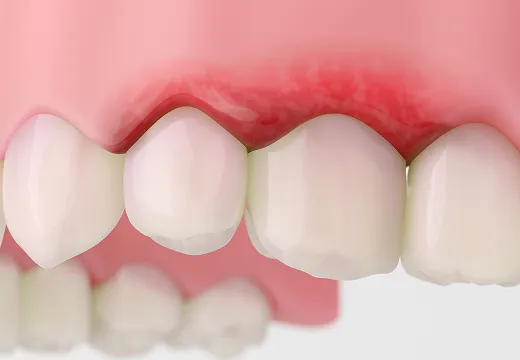Concept Image